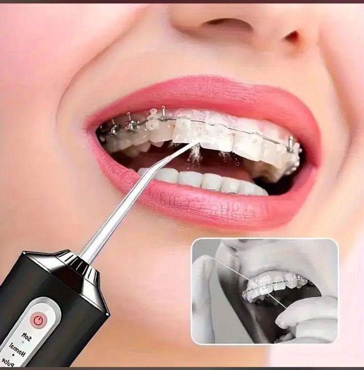 Irrigador Oral Dental Recargable Bucal